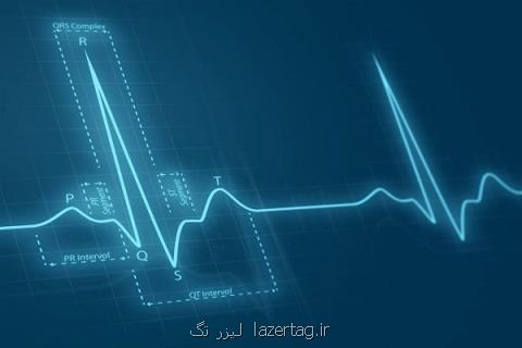 هوش مصنوعی تشخیص سریع بیماری های قلبی را ممكن می كند