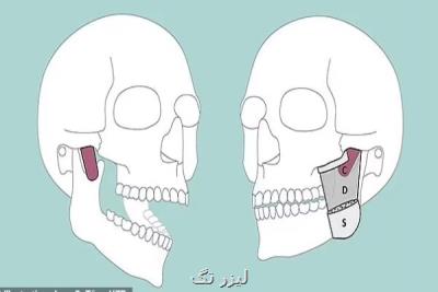 یک عضله جدید در فک انسان کشف شد
