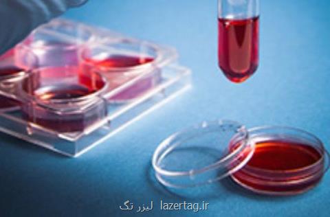 اثبات بی خطر بودن یك داروی آزمایشگاهی برای درمان لوكمیا