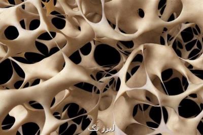 ترمیم ضایعات استخوانی با یك ساختار جدید